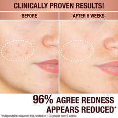 DARK SPOT CORRECTING RADIANCE RECOVERY SERUM - 10 ML