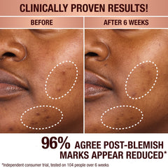 DARK SPOT CORRECTING RADIANCE RECOVERY SERUM - 30 ML